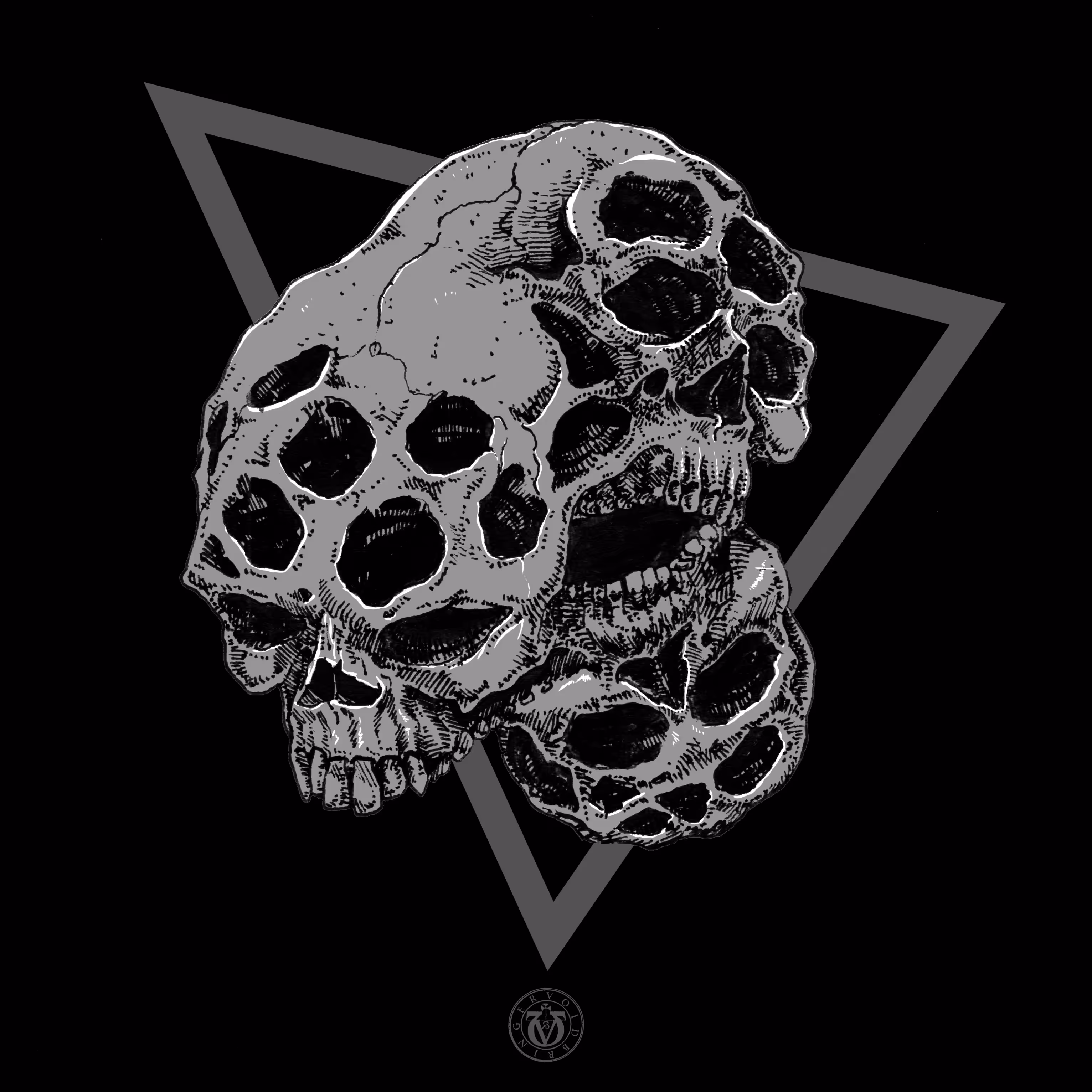 Skull Deformity