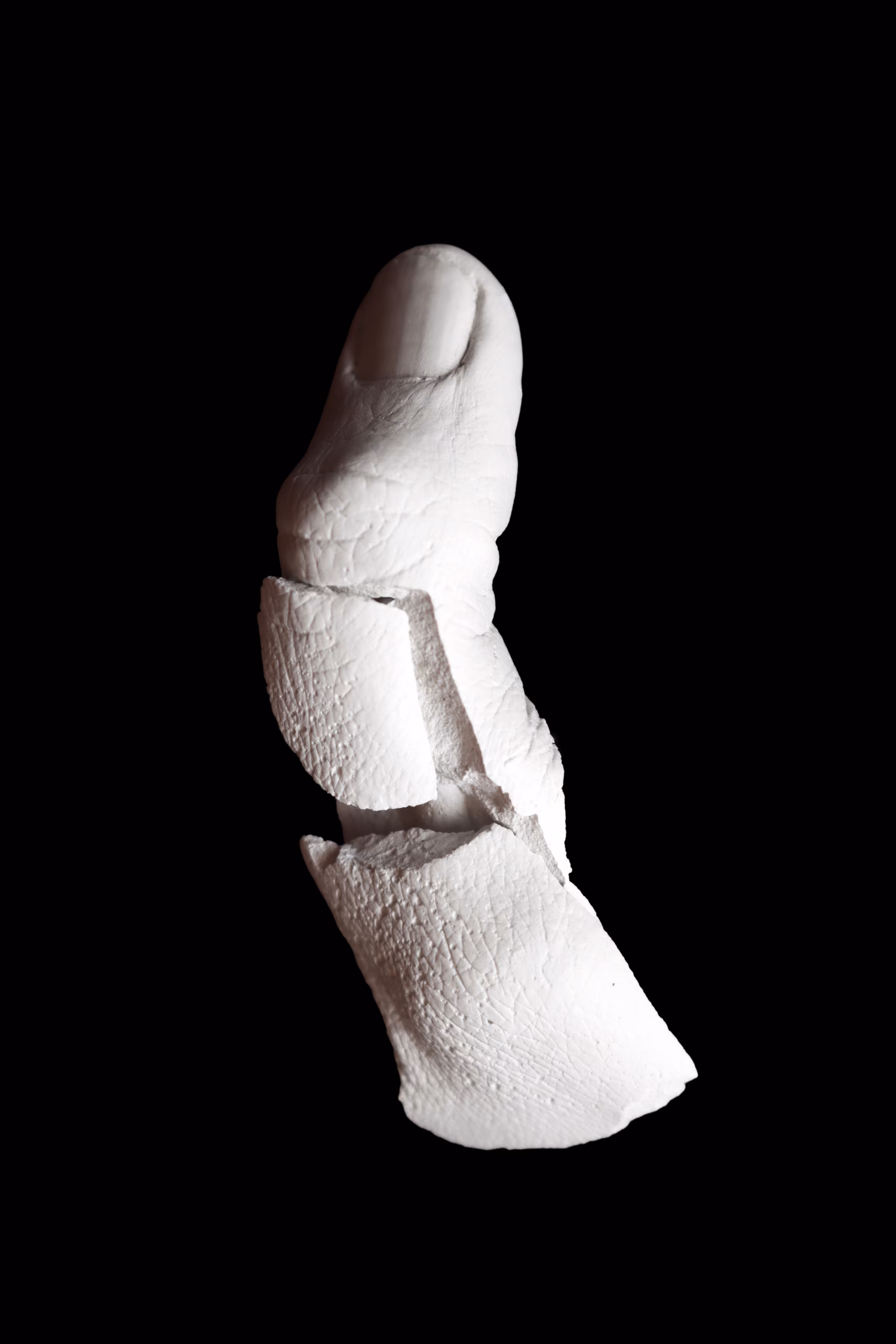 Broken finger