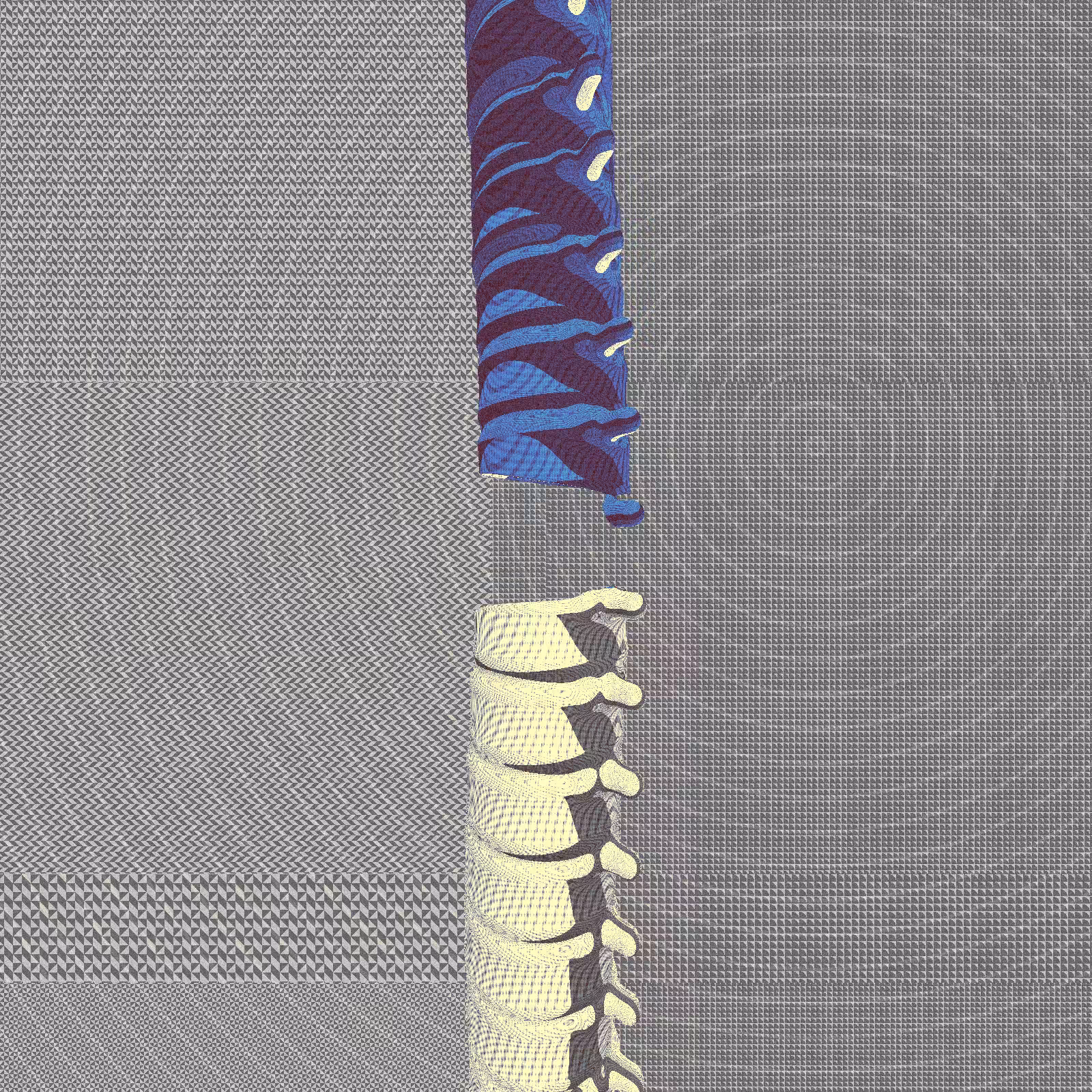 Long, Thin, Tubular Structure #101