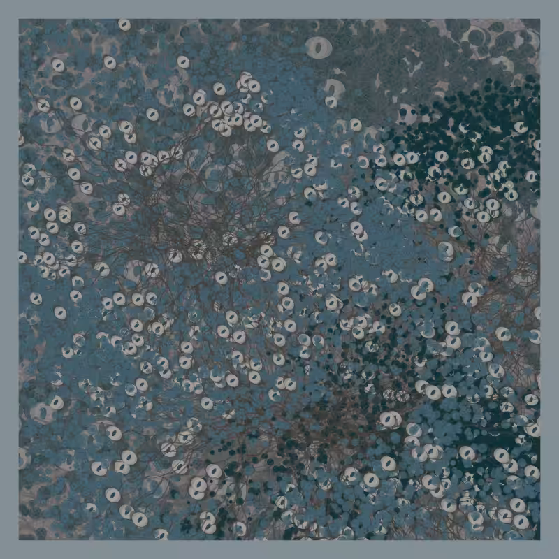 Jellyfish #87