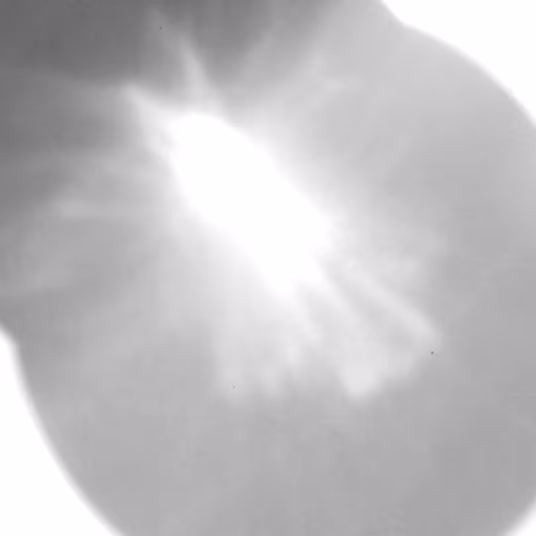 SQUARE122 - 100x Speed of Light