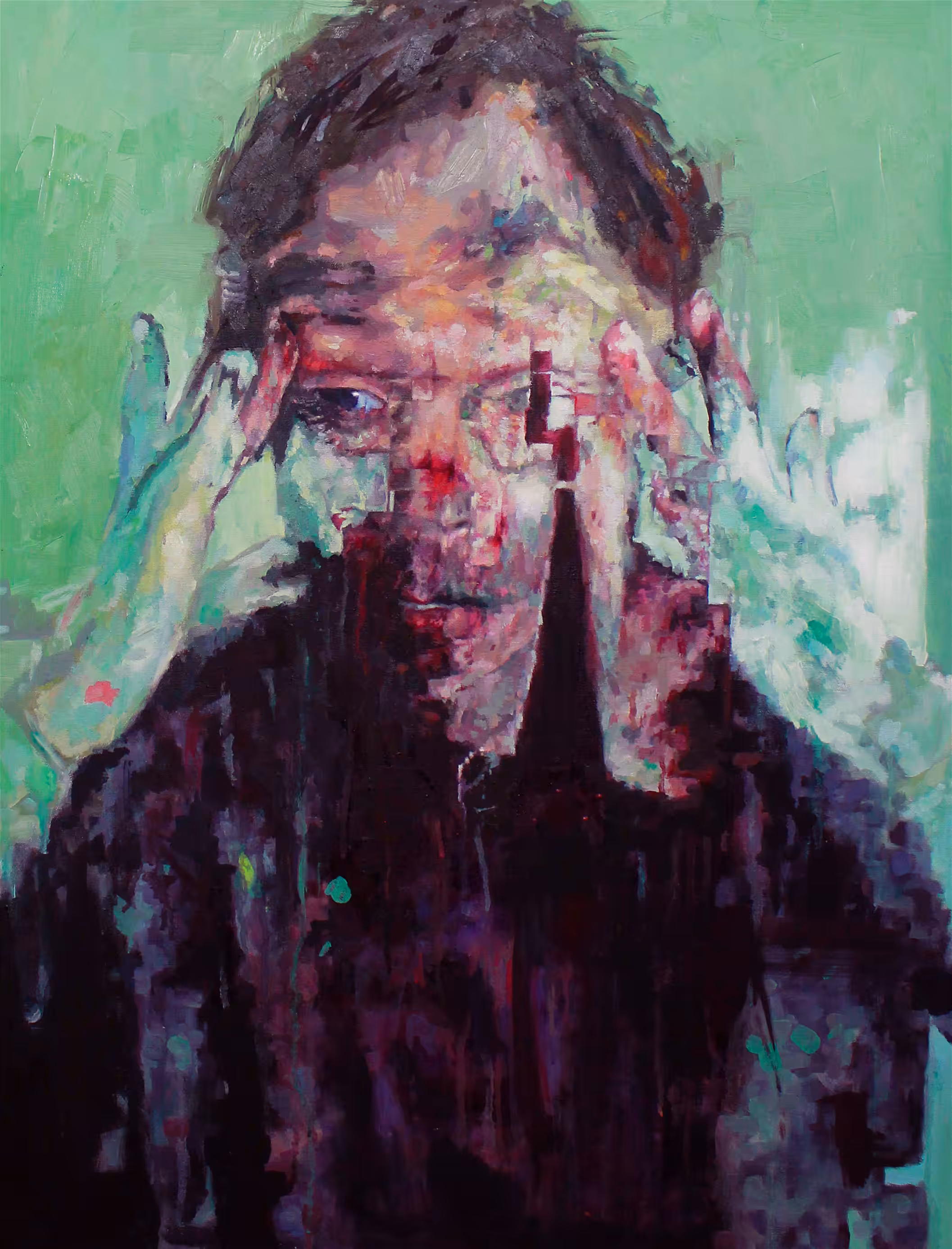Prosopagnosia