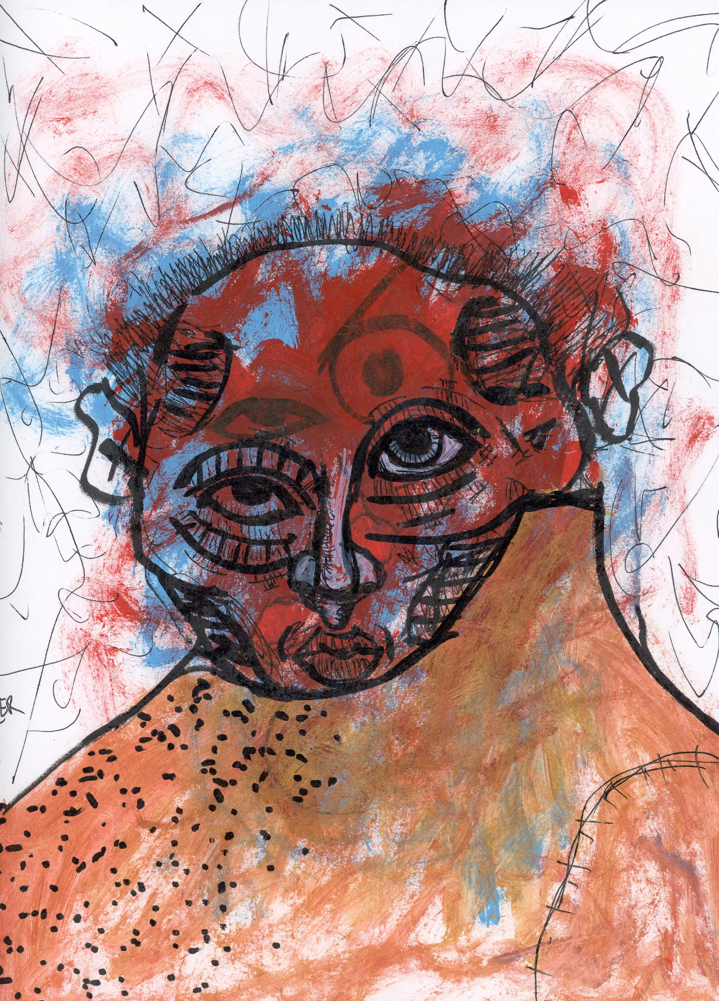 Schizophrenic thought he was an emperor in gold