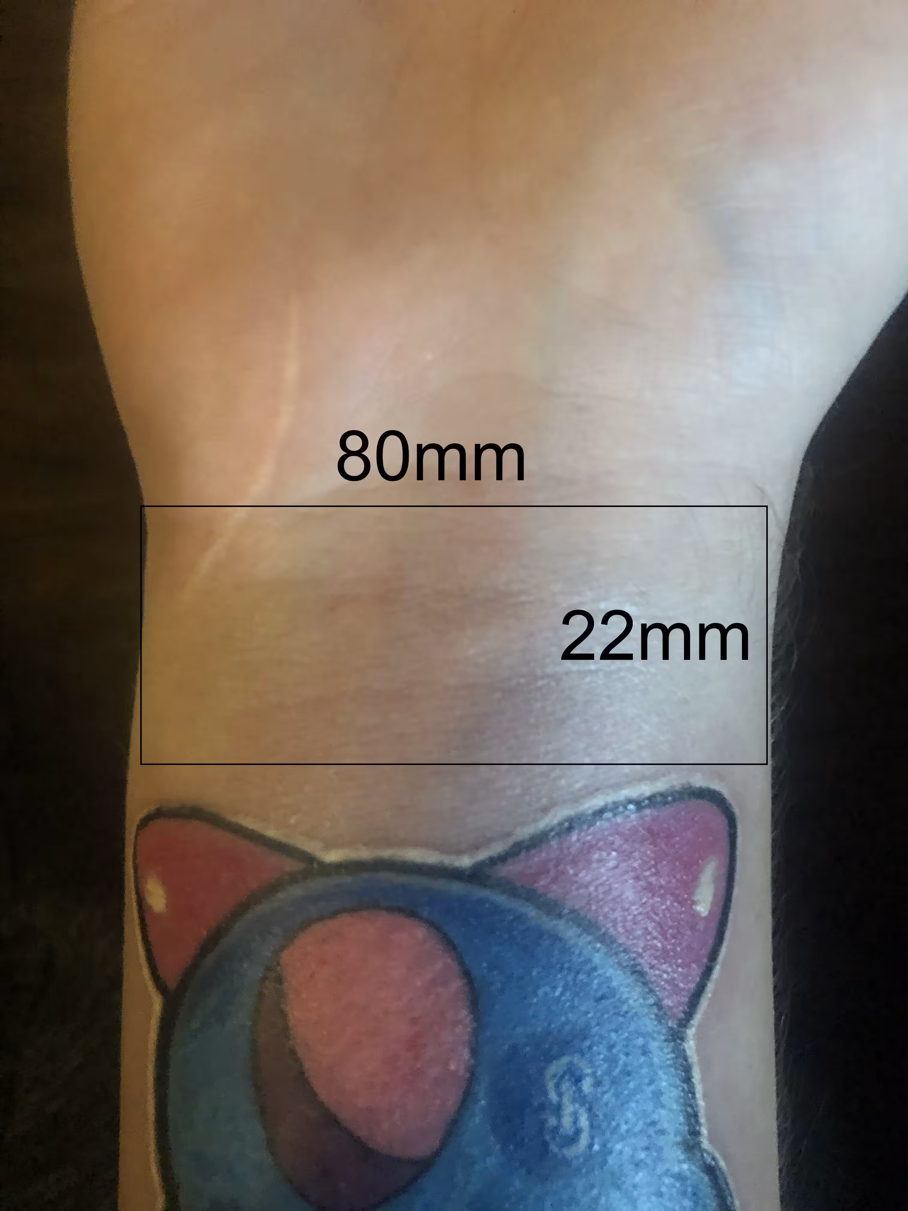 Lot #8 [80mm x 22mm - Right Wrist Inner]