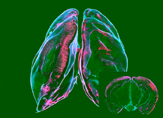 Alien's first brain MRI