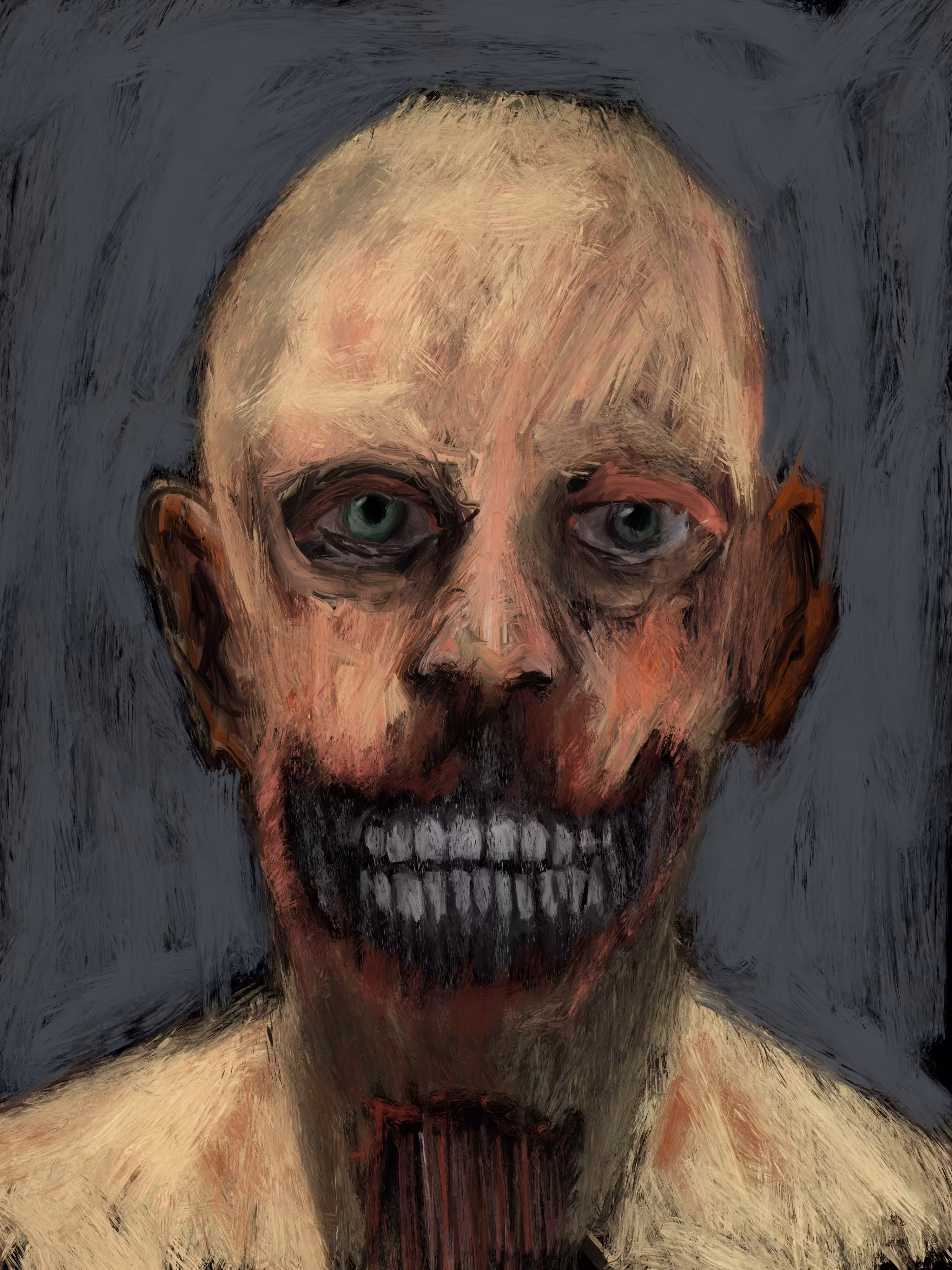 X Ray