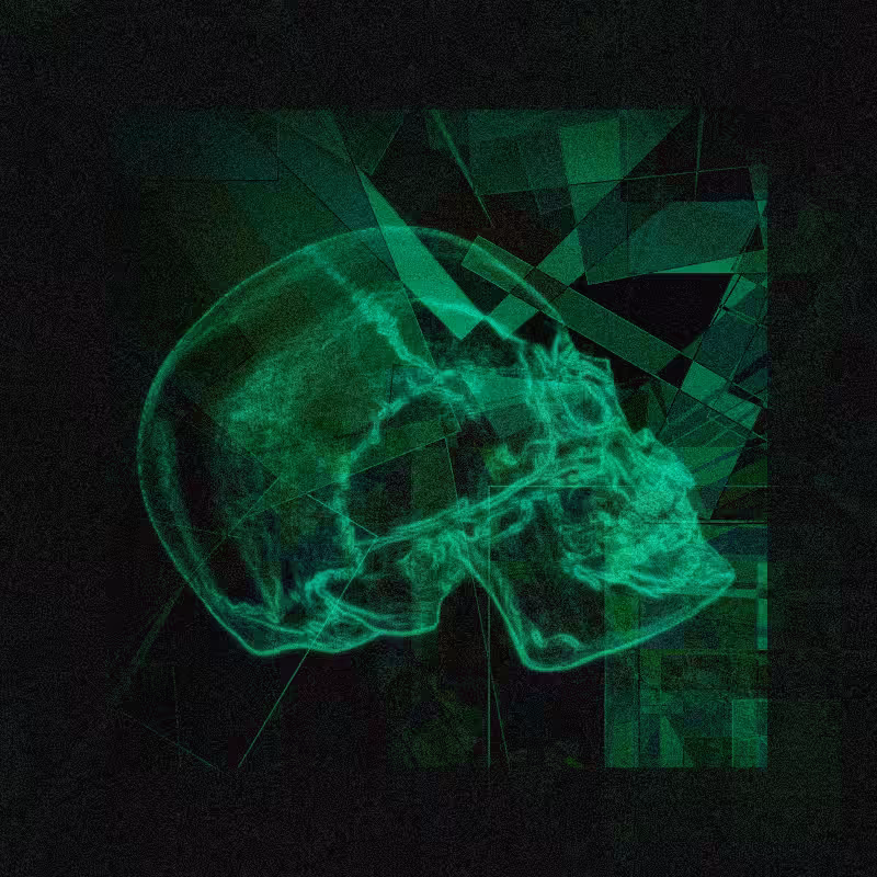 X-ray of a skull #9