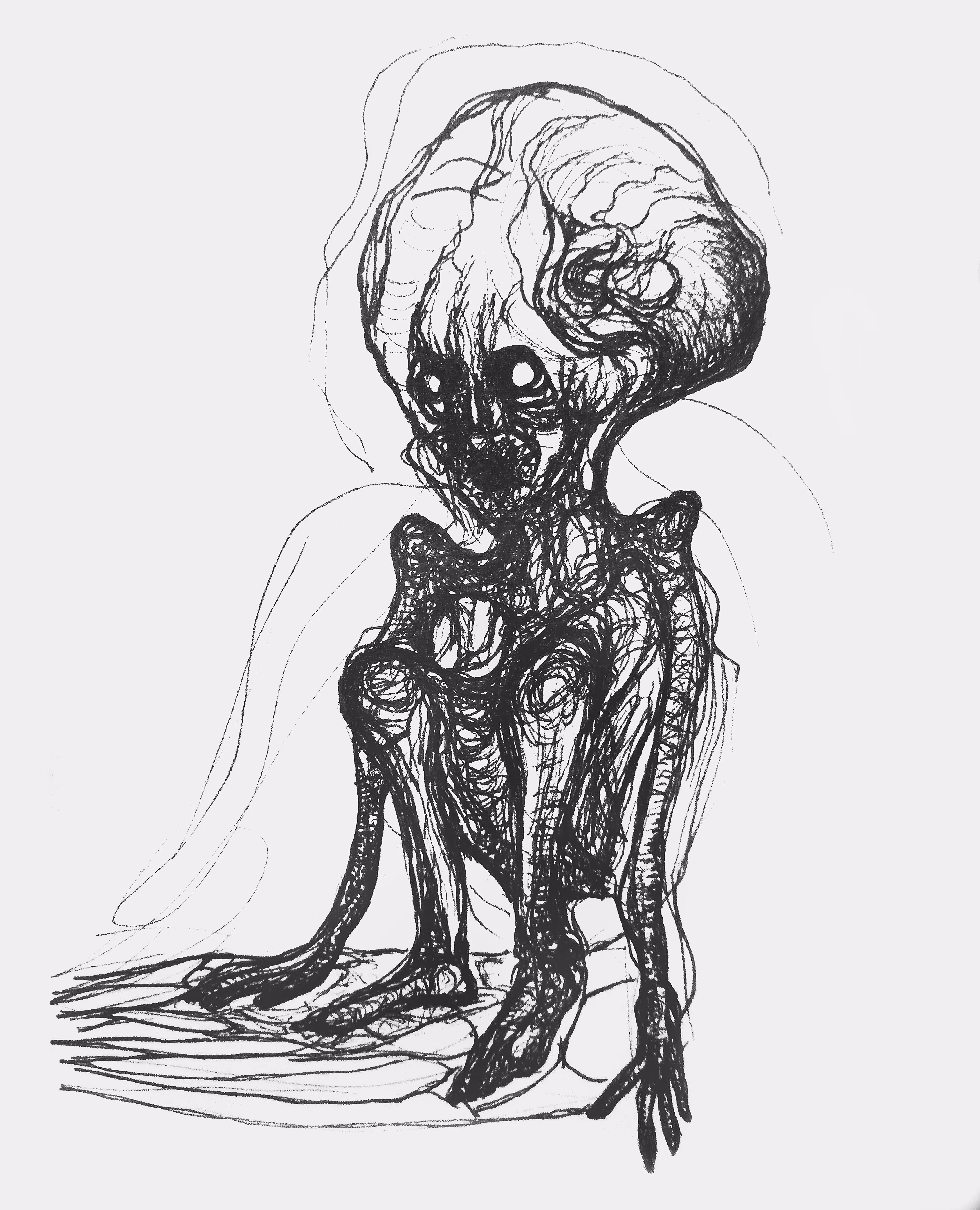 Anxiety