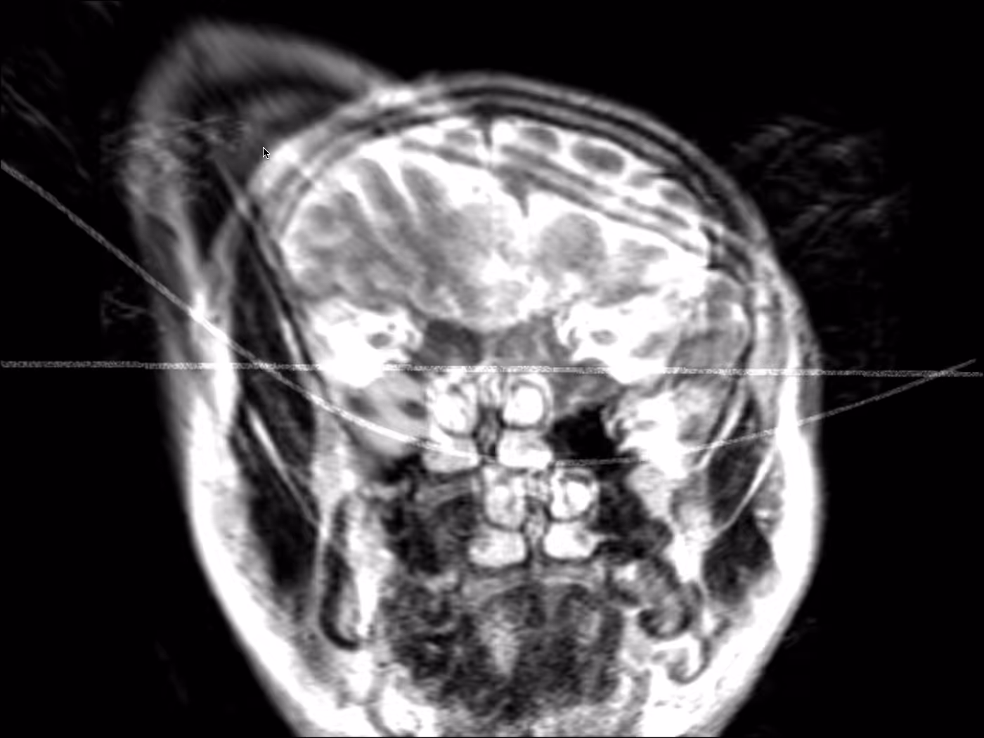 Brain Scan II