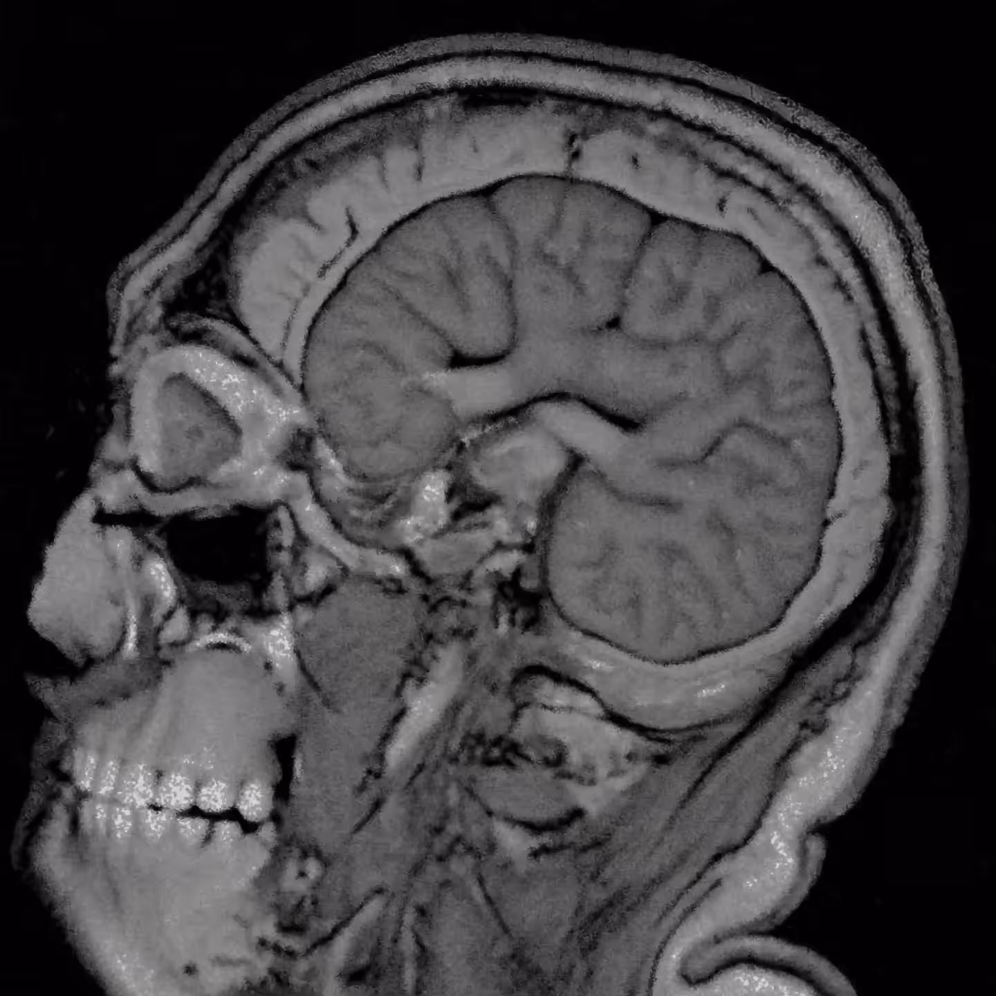 SAG_skull_obl_trace_RECON(2)-x.ai