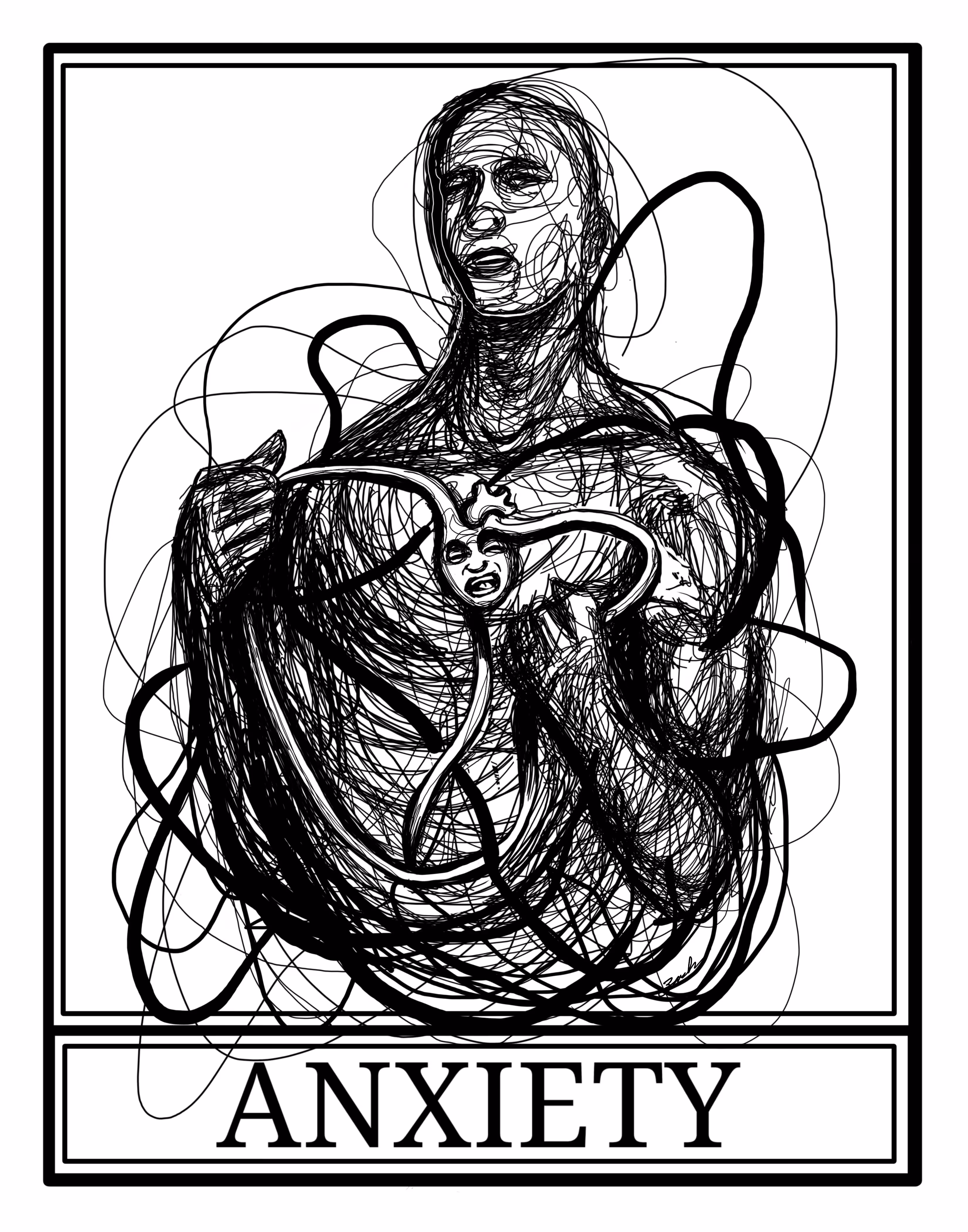 Anxiety