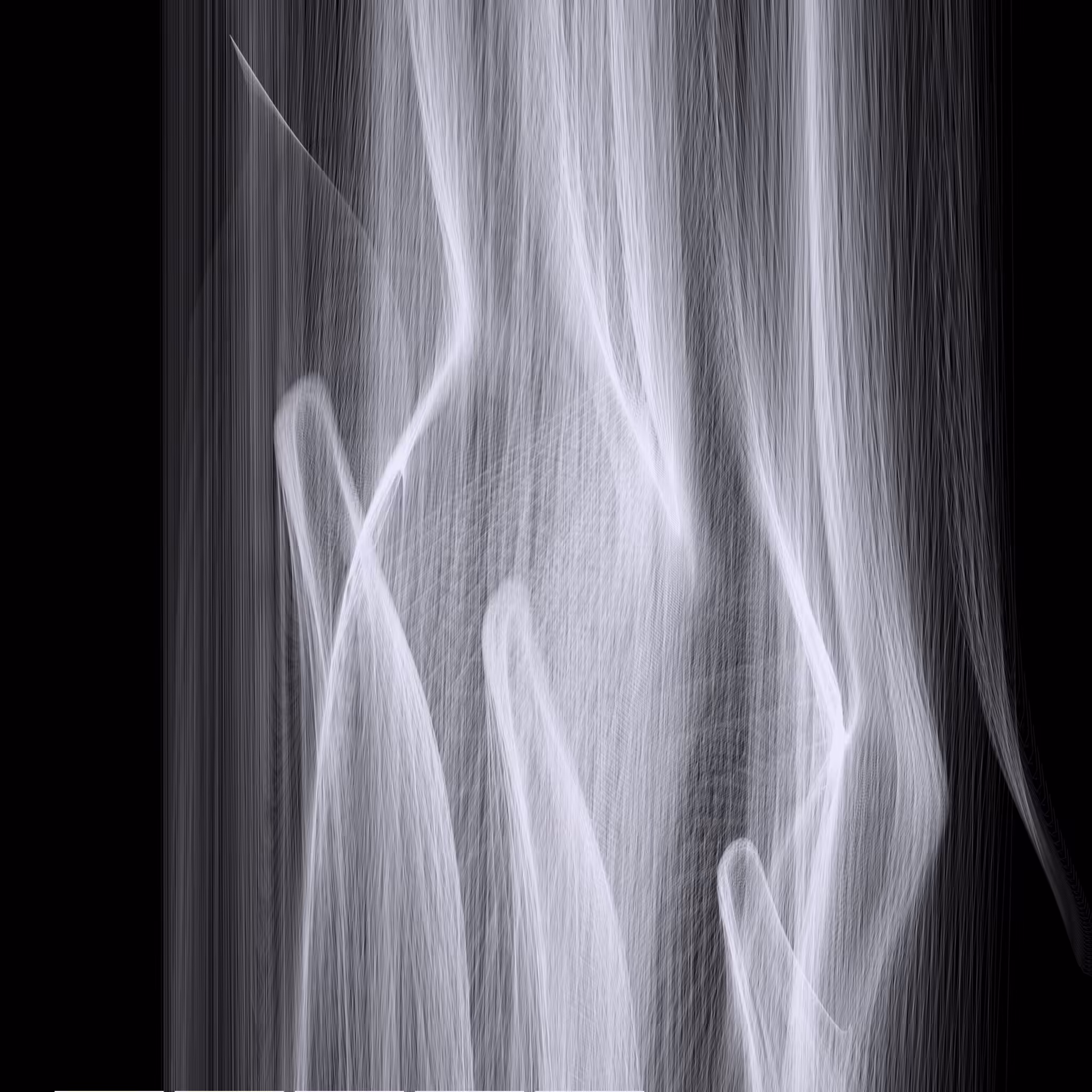 Rays of Light II #15