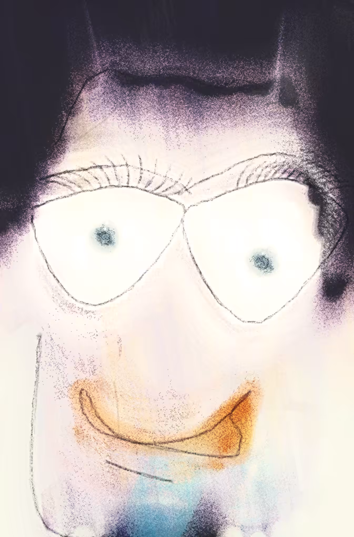 #315