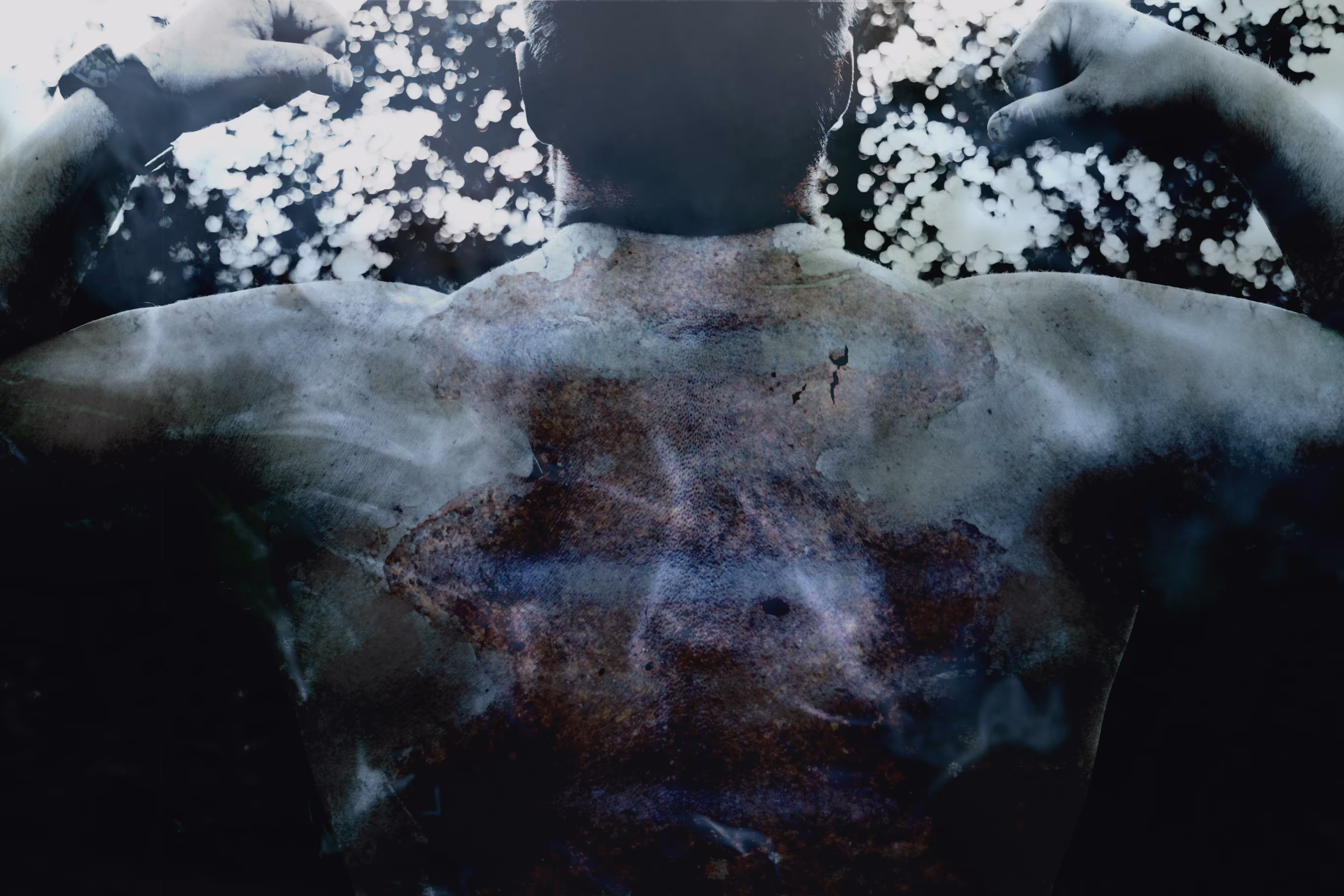 _scars