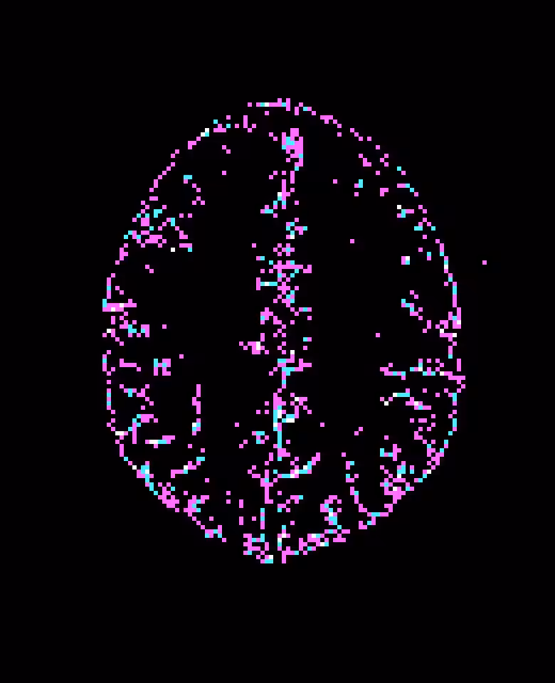 my lightning network