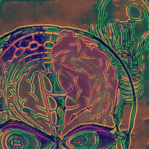 Bitcoin on the Brain
