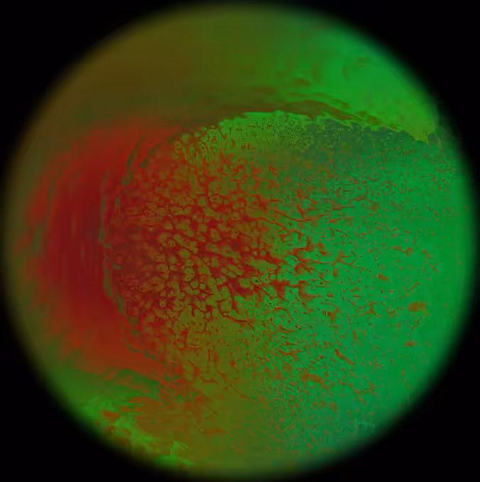 Lens 13