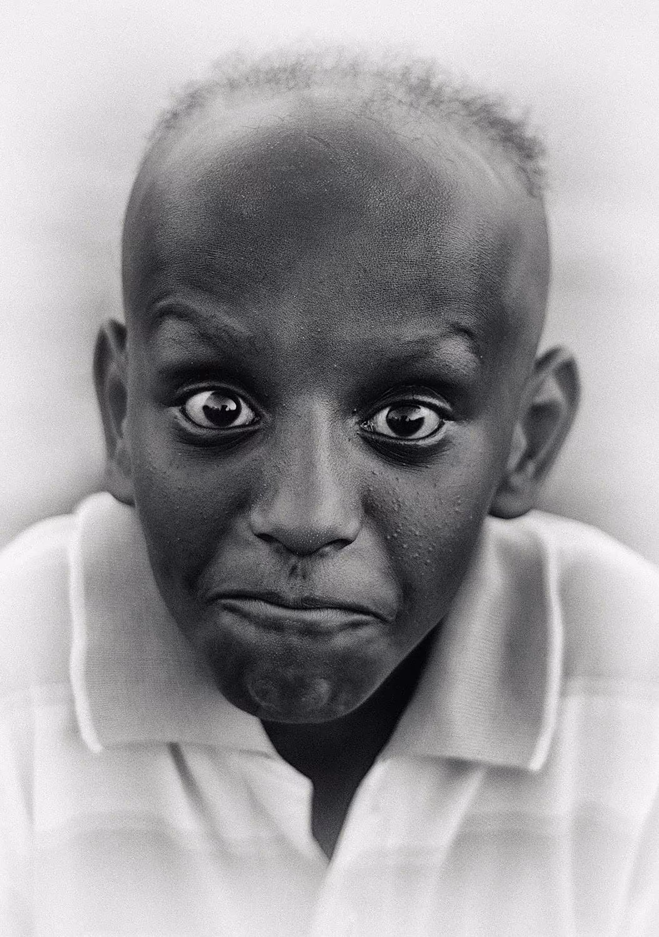 The eyes