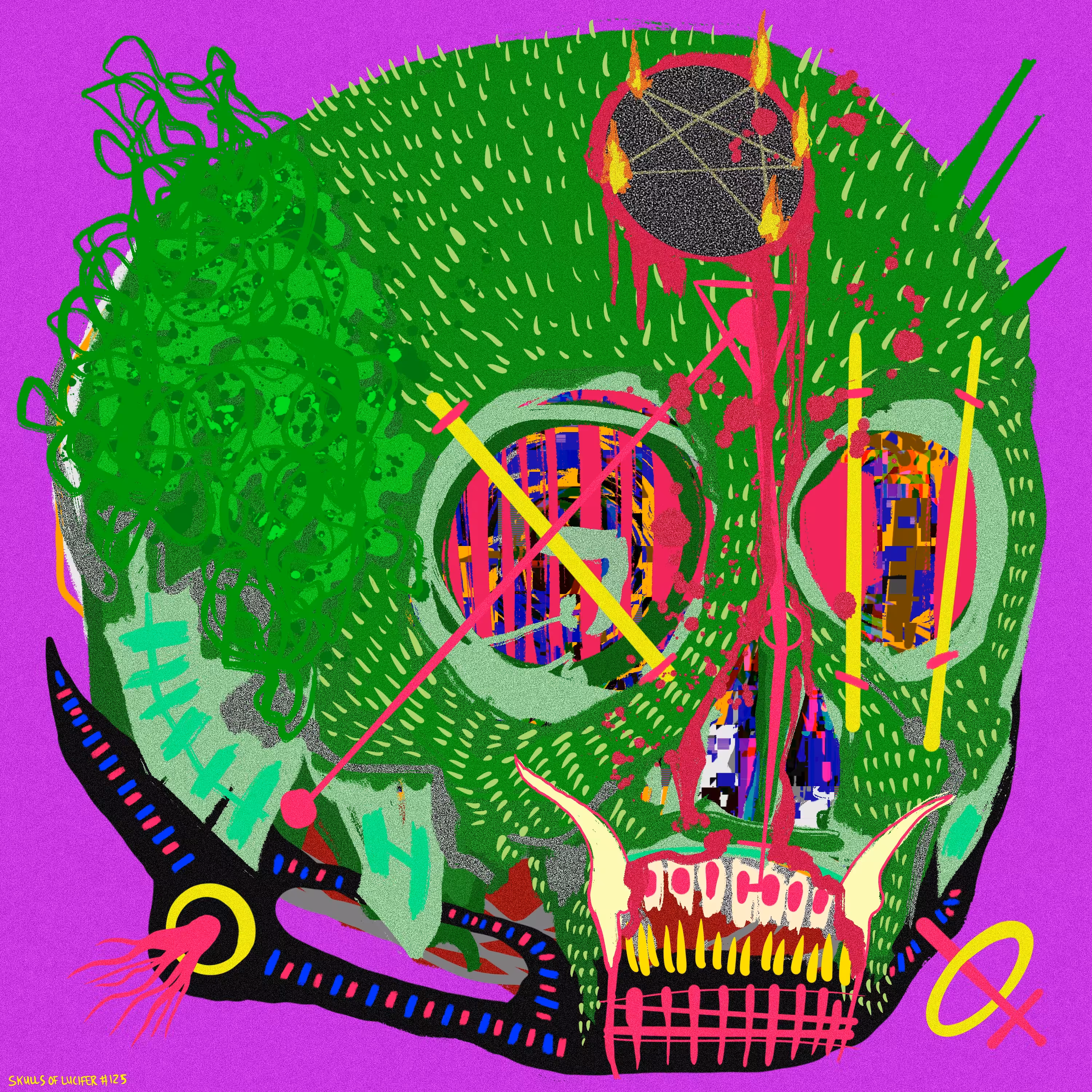 Gangrenous Blitzkrieg of the Parietal