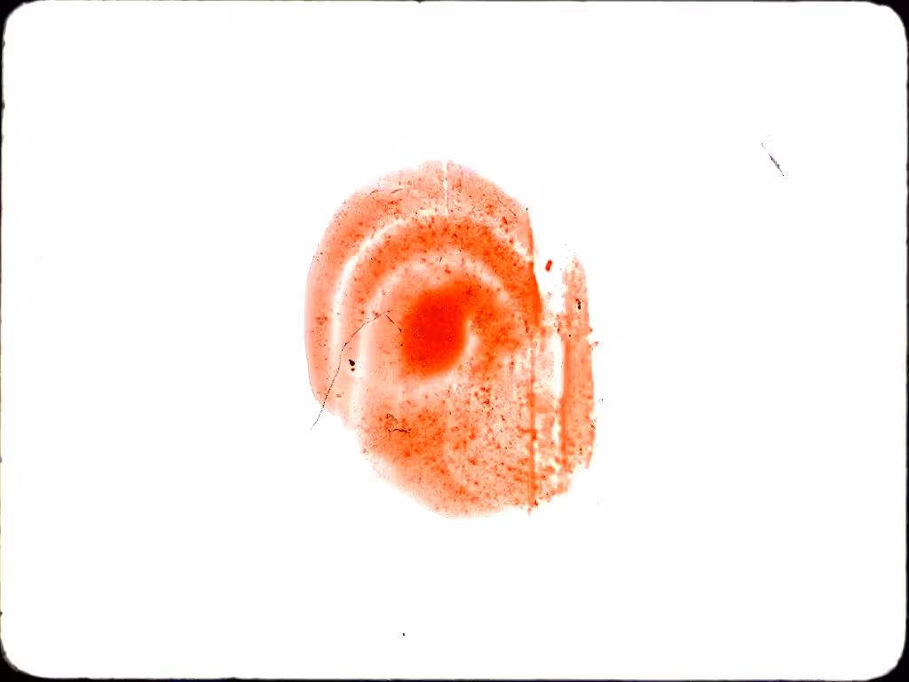 Orange Dot Test