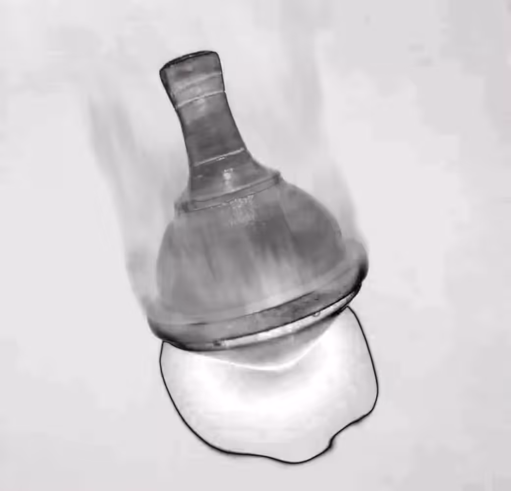 Fiery spinning top