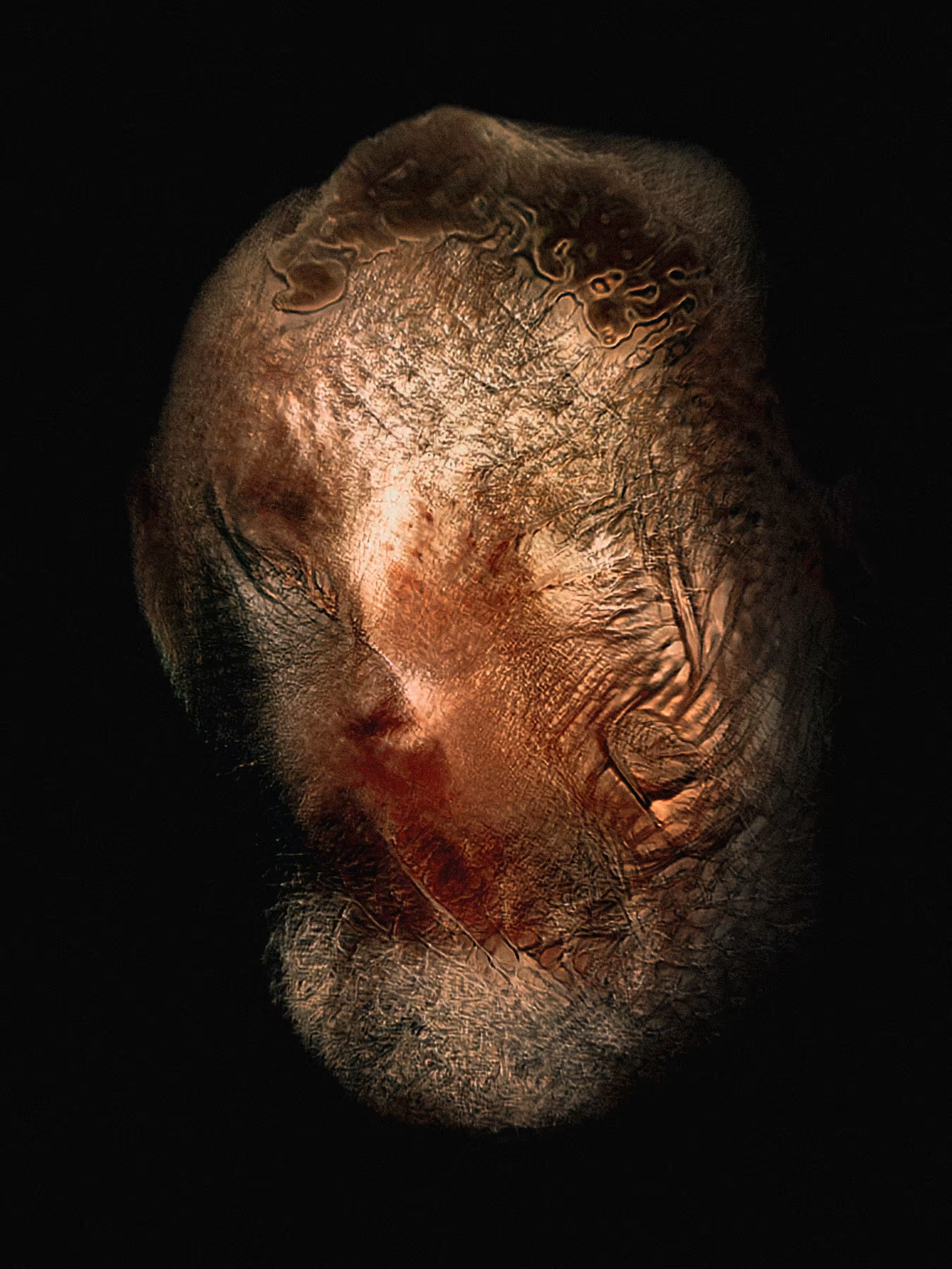 Decrepit Atrophy