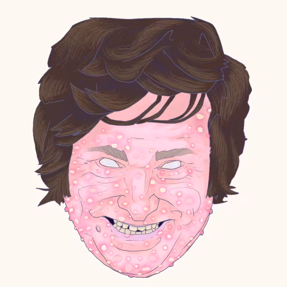 La cabeza muerta de Javier