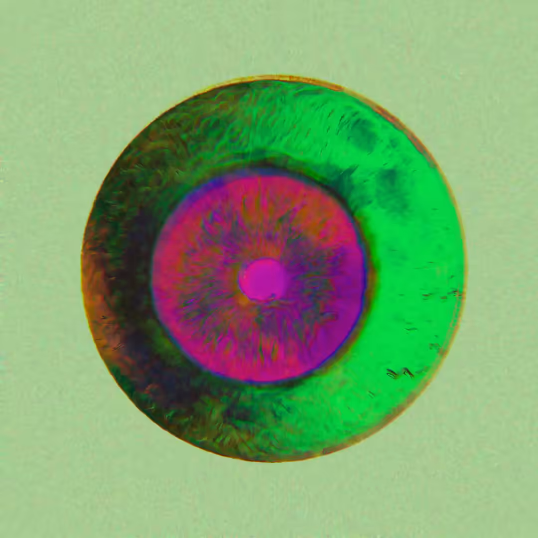 ICTUS