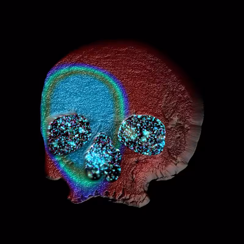 💀ACID SKULL🌈 #7