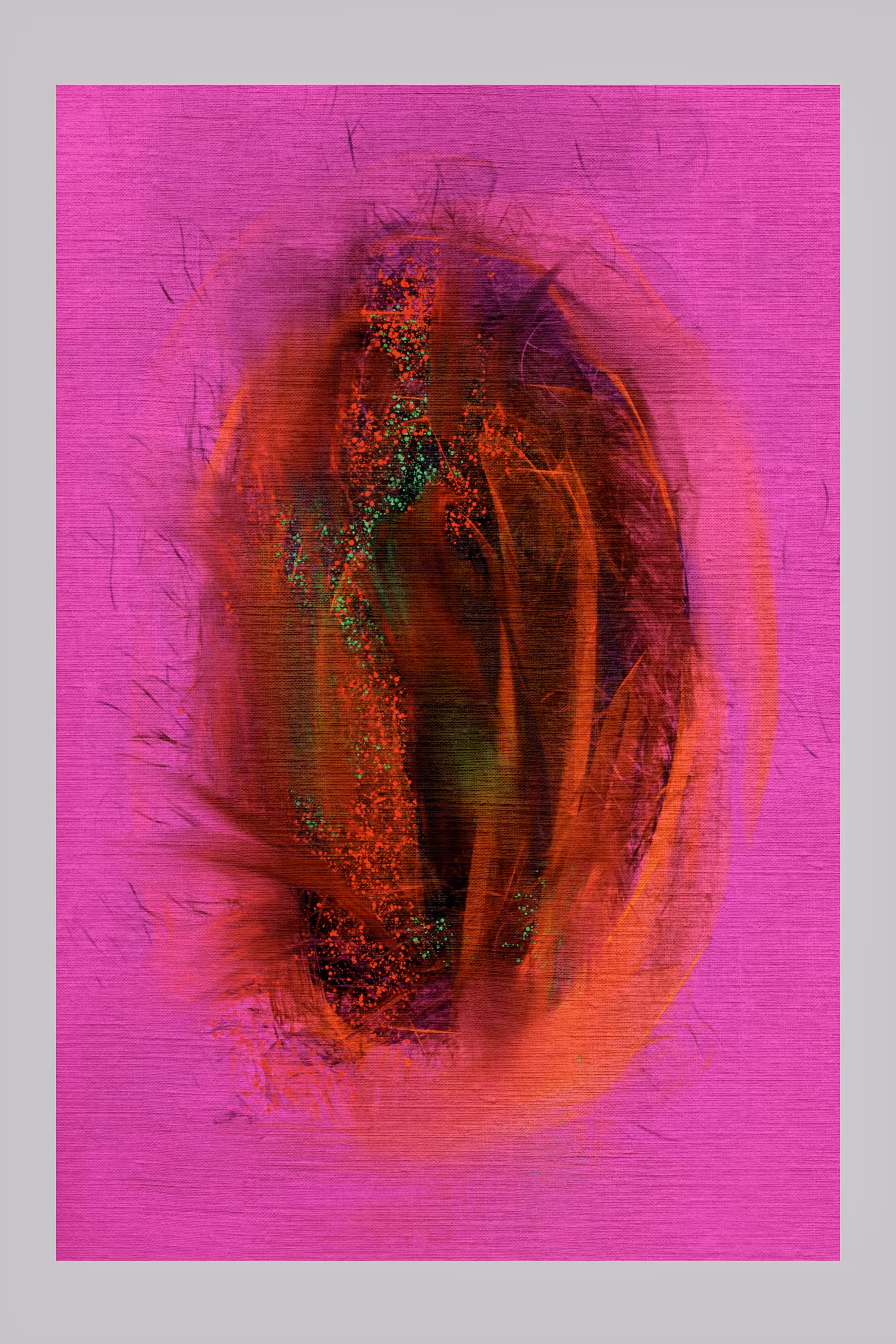 Abstract 87