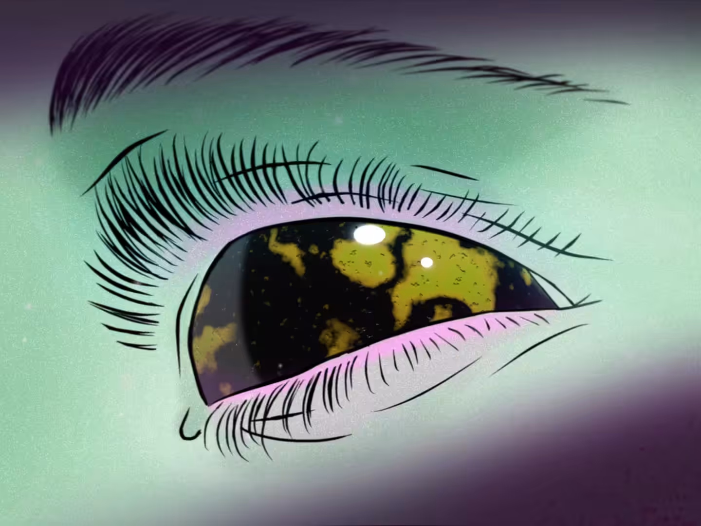  Lazy Eye #2