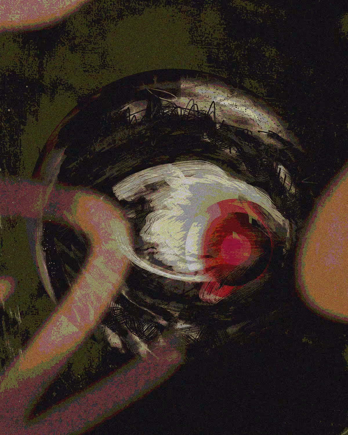 Eye Disease