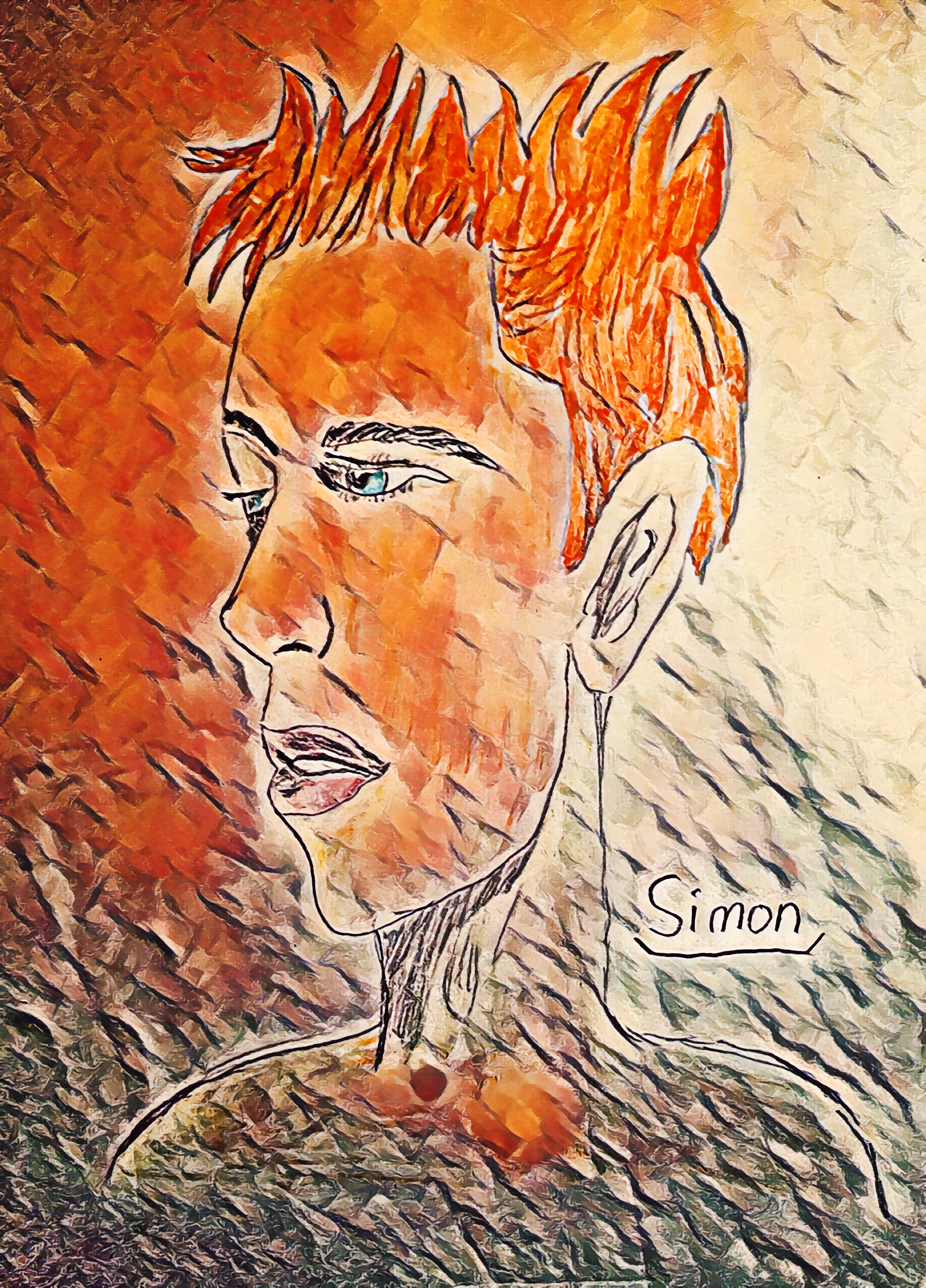 Sunburn Simon