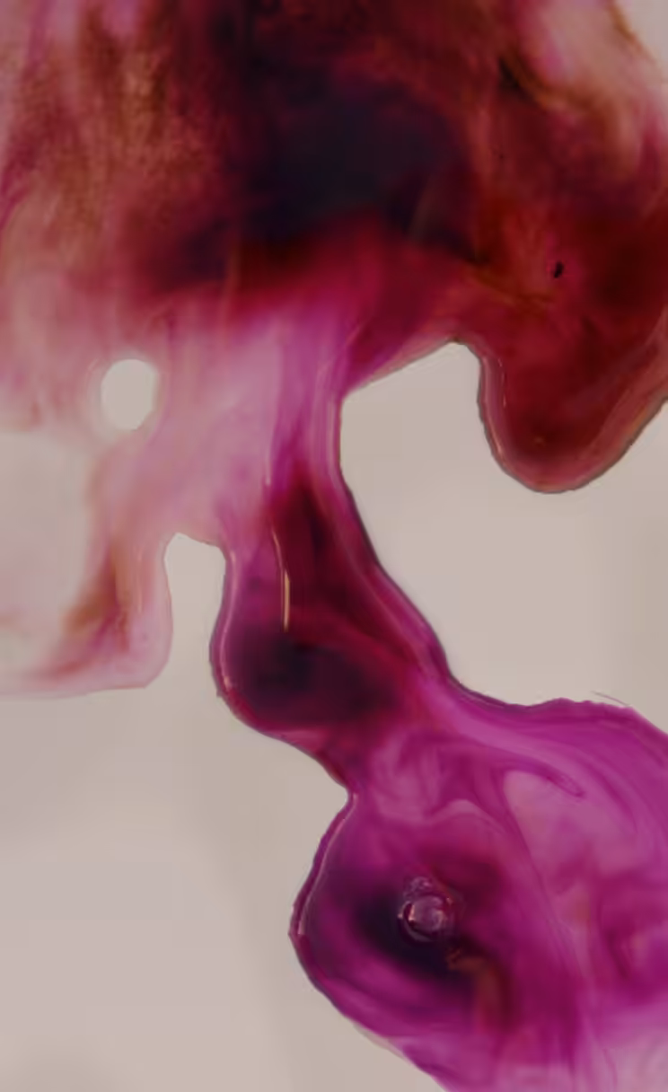 LOVOTIC – II