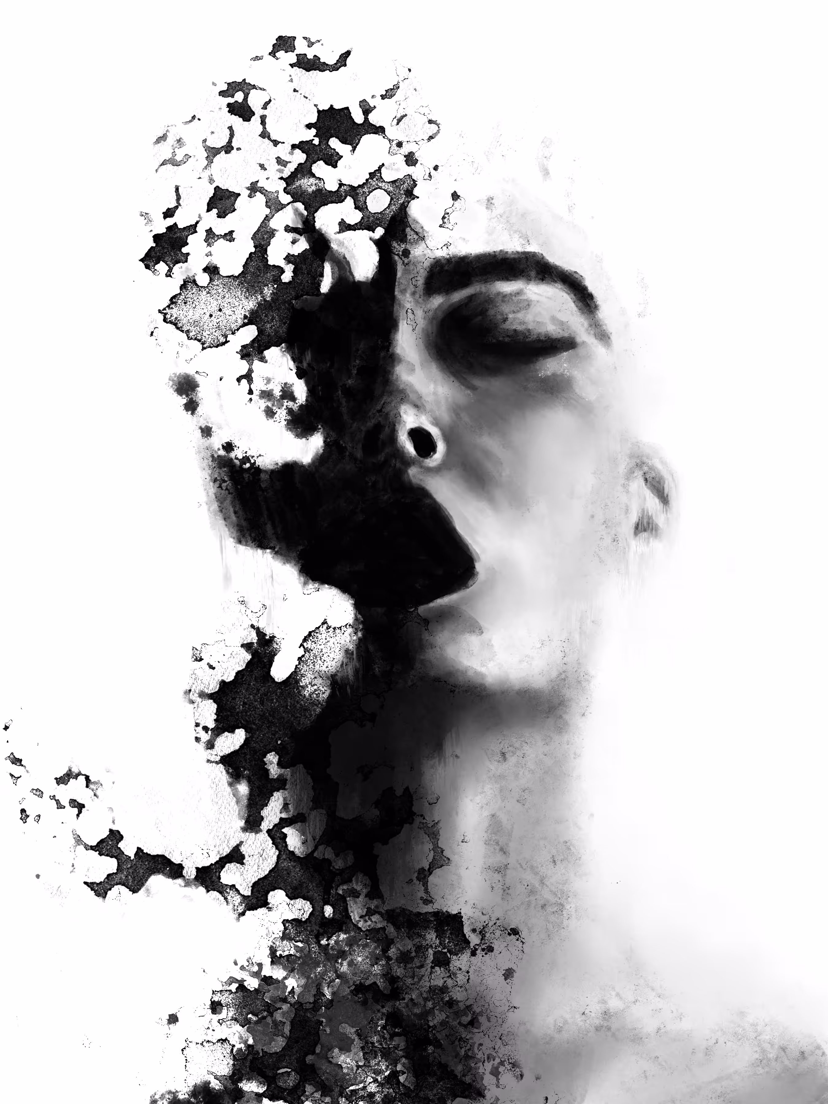 Depression