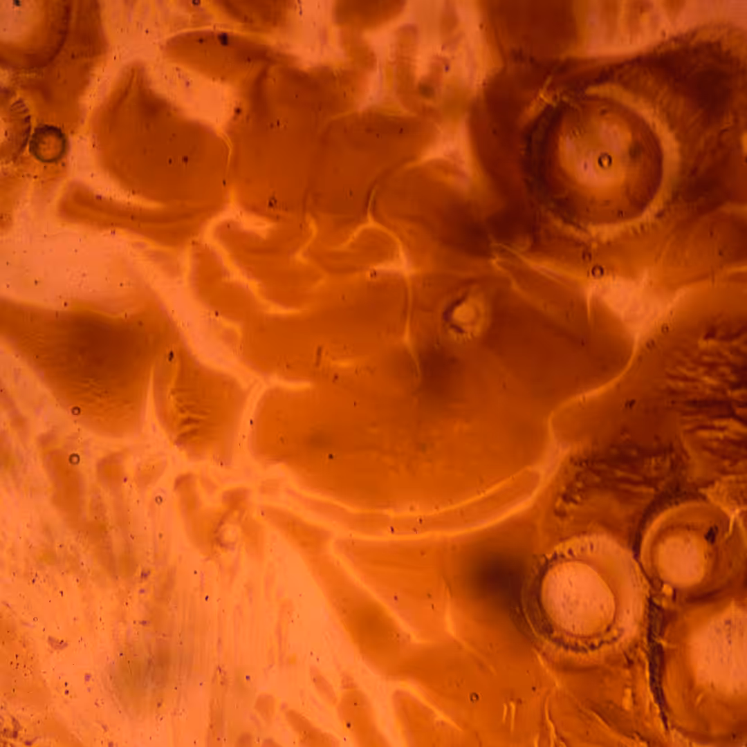 Abstract 6
