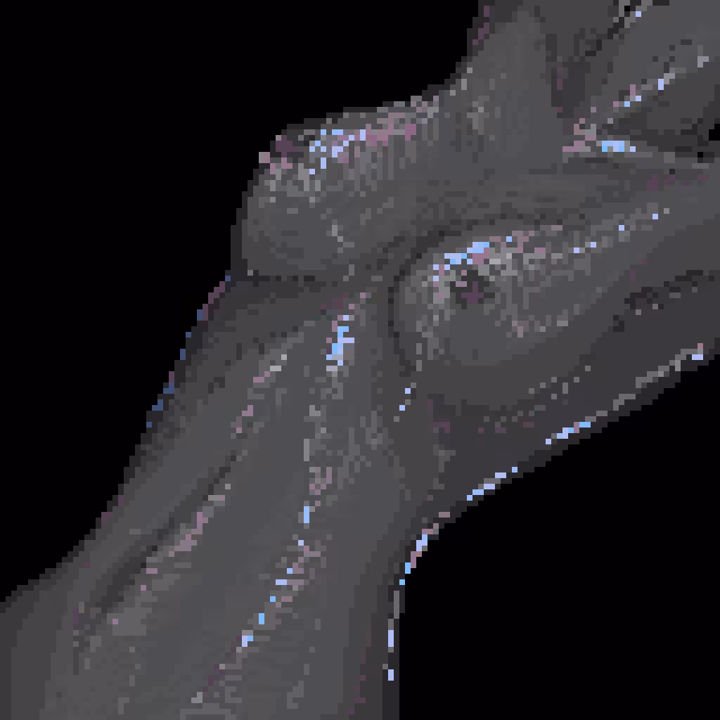 dark matter