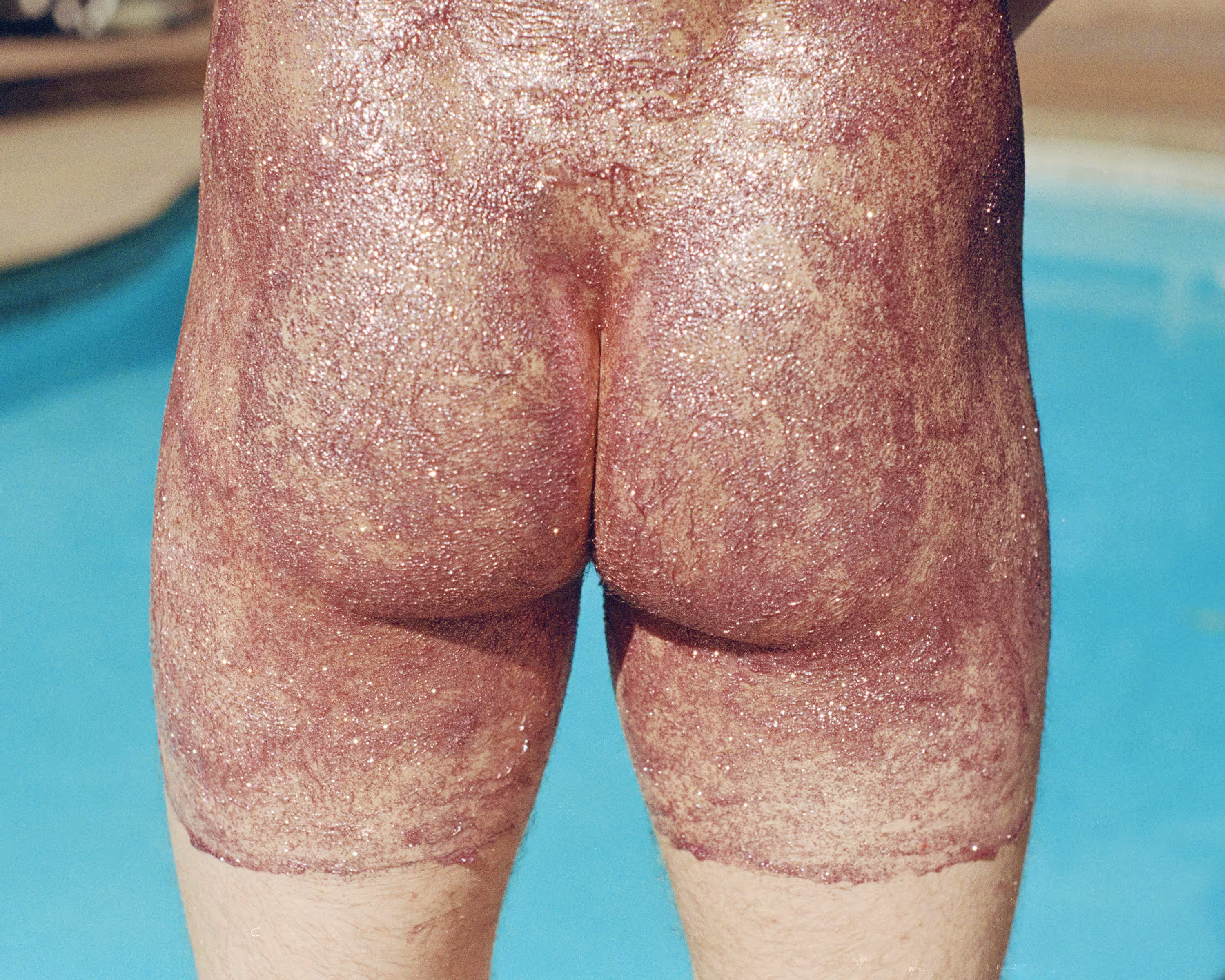 Glitter