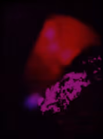 L’il Fucktwattt the 3th on acid datin’ a girl called Mollly
