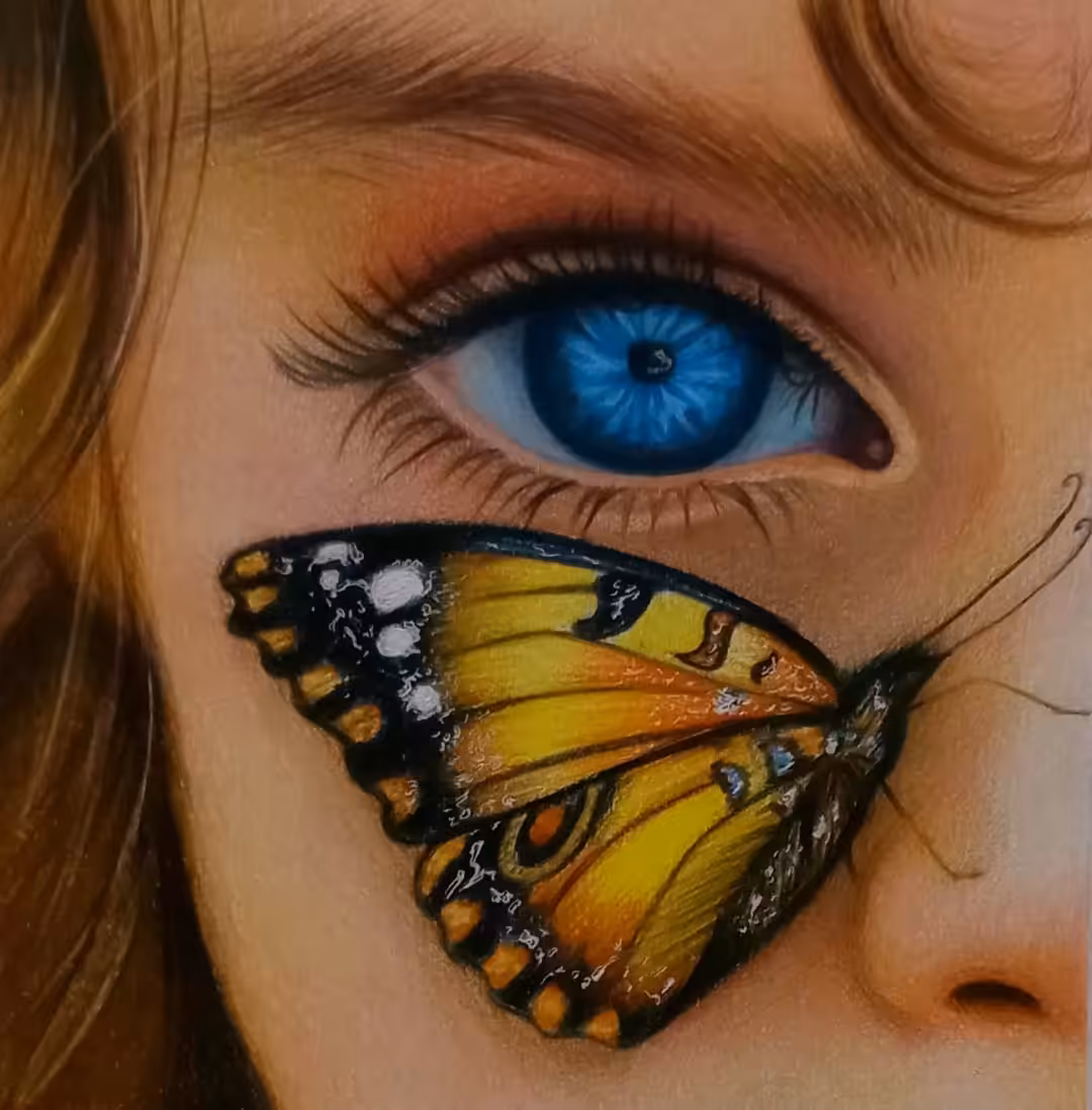 Eb ( Butterfly disease)