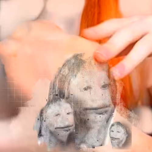 augmentation