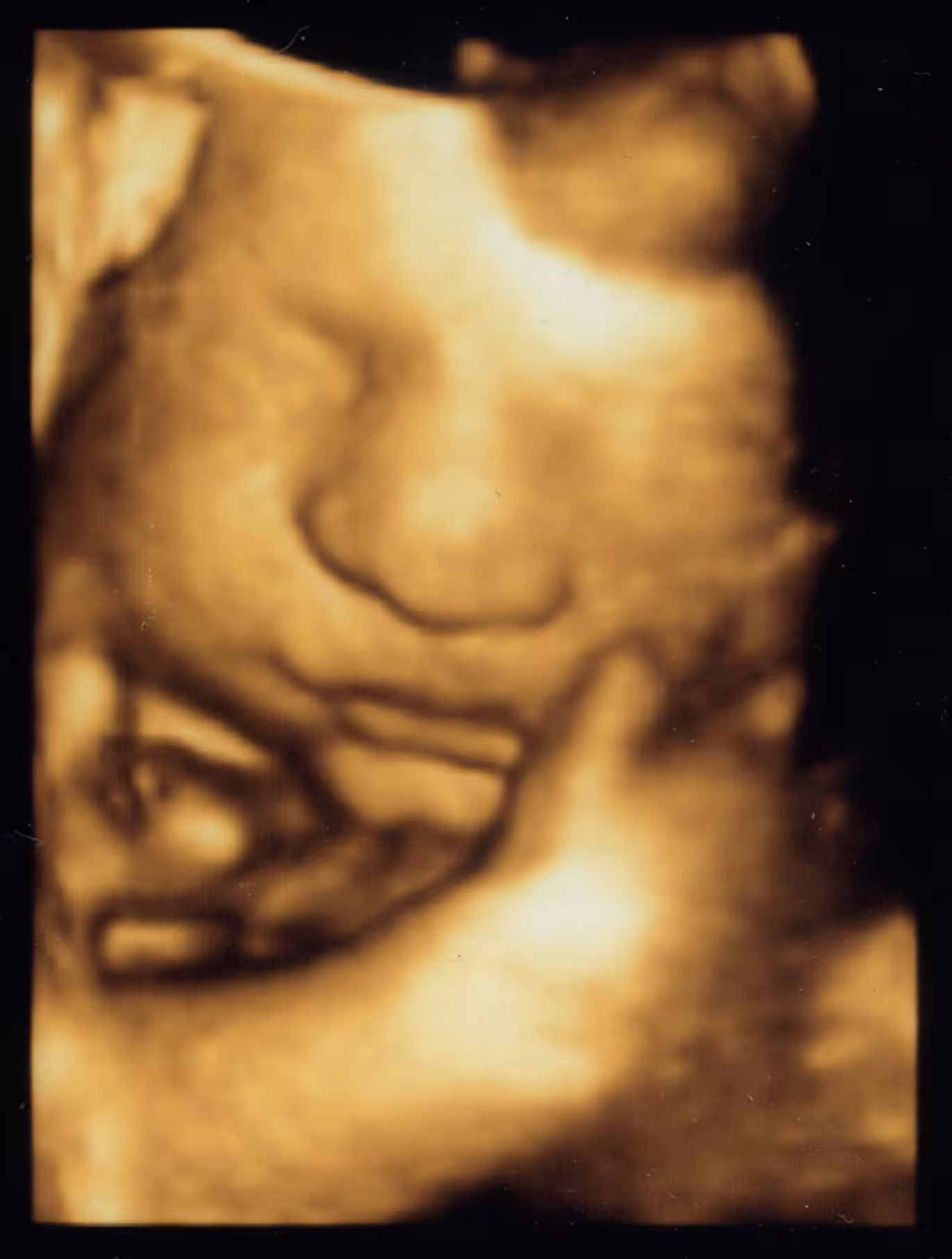 The Most Minimalist NFT, Baby