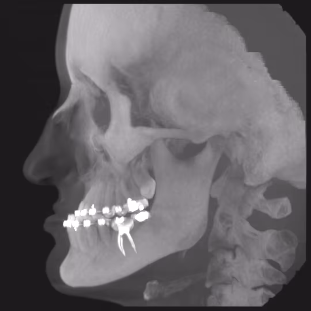 Anonymized CT scan 03