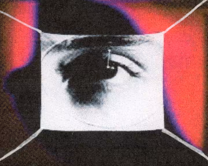 EYE