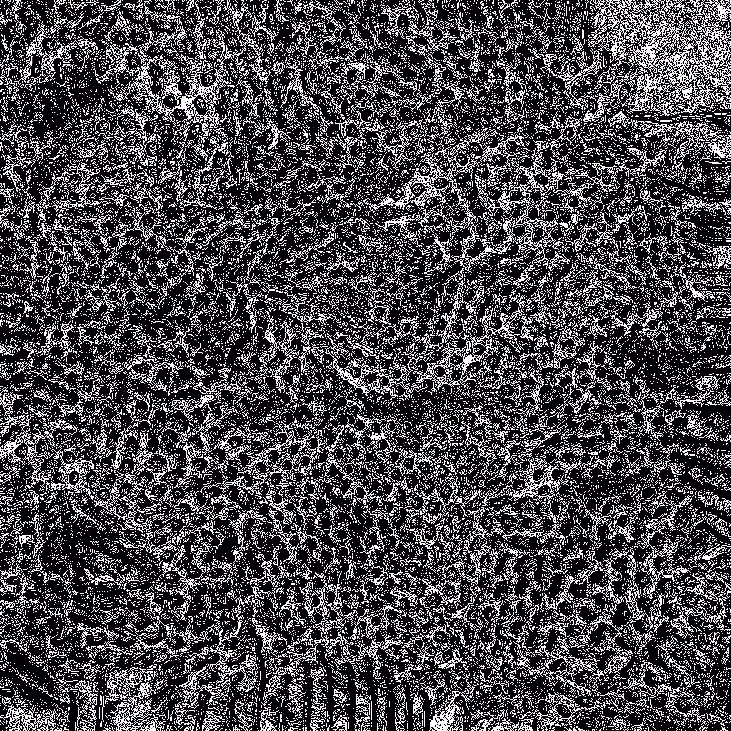 HIDDEN IN NOISE: Noise #847 