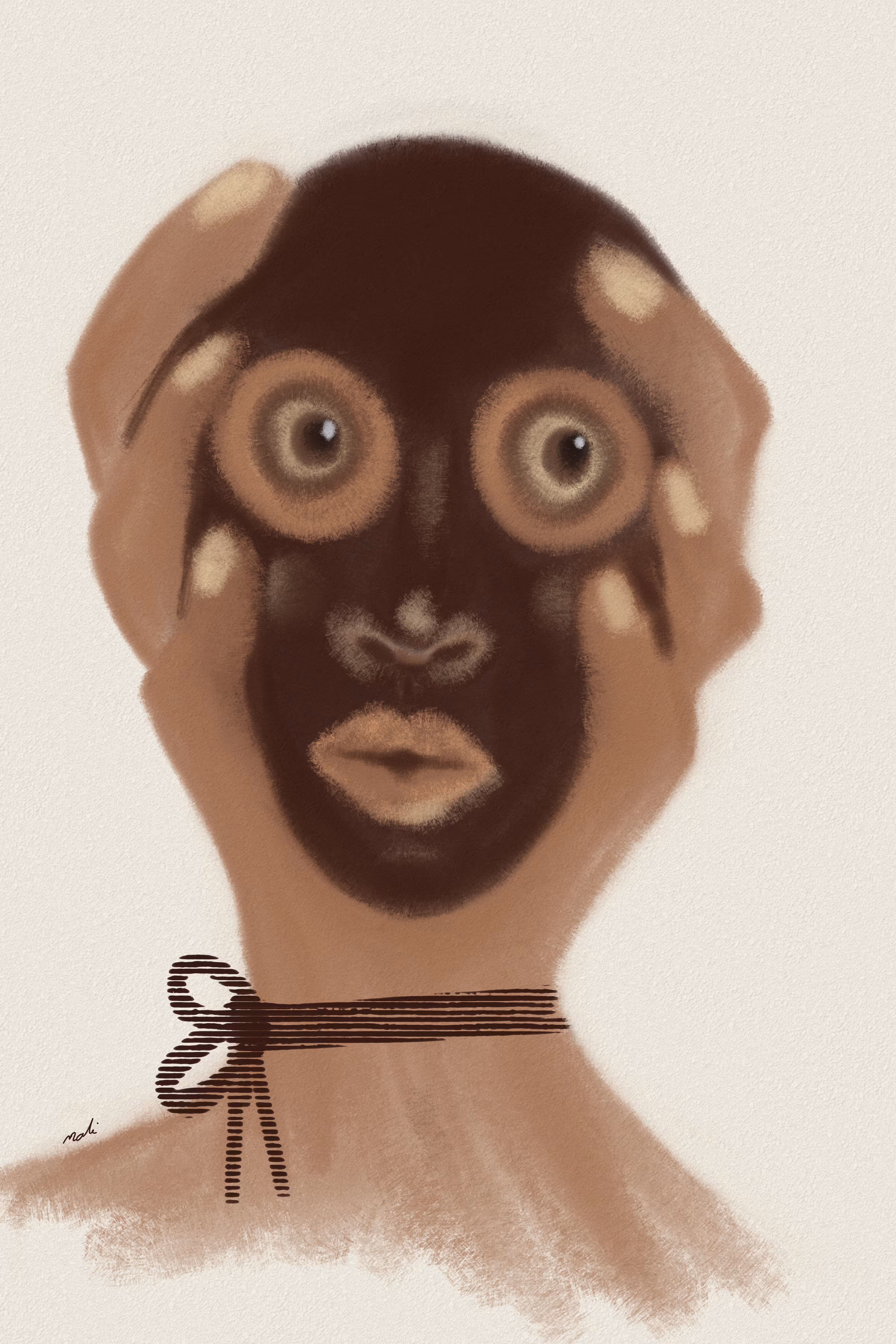 Trauma