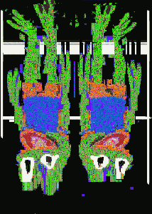 Two Pepes 