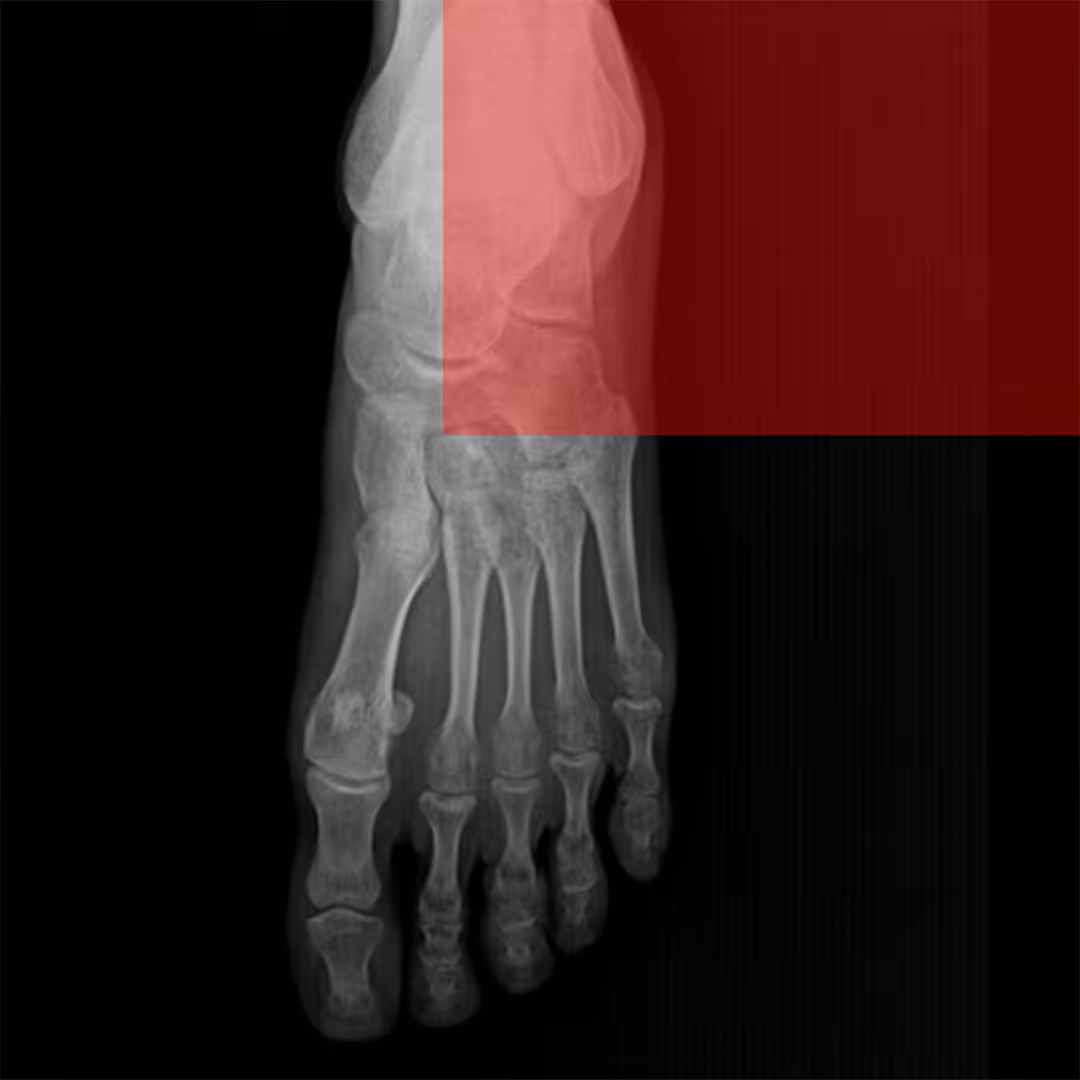 X-Ray_04