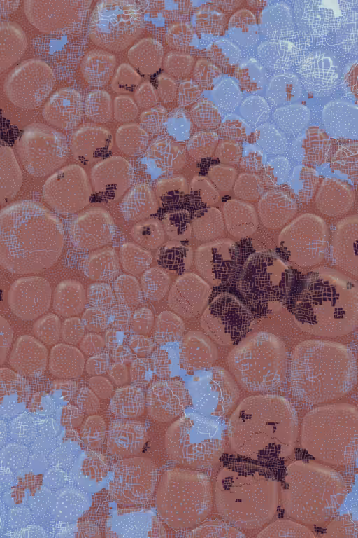 Vitreous #3