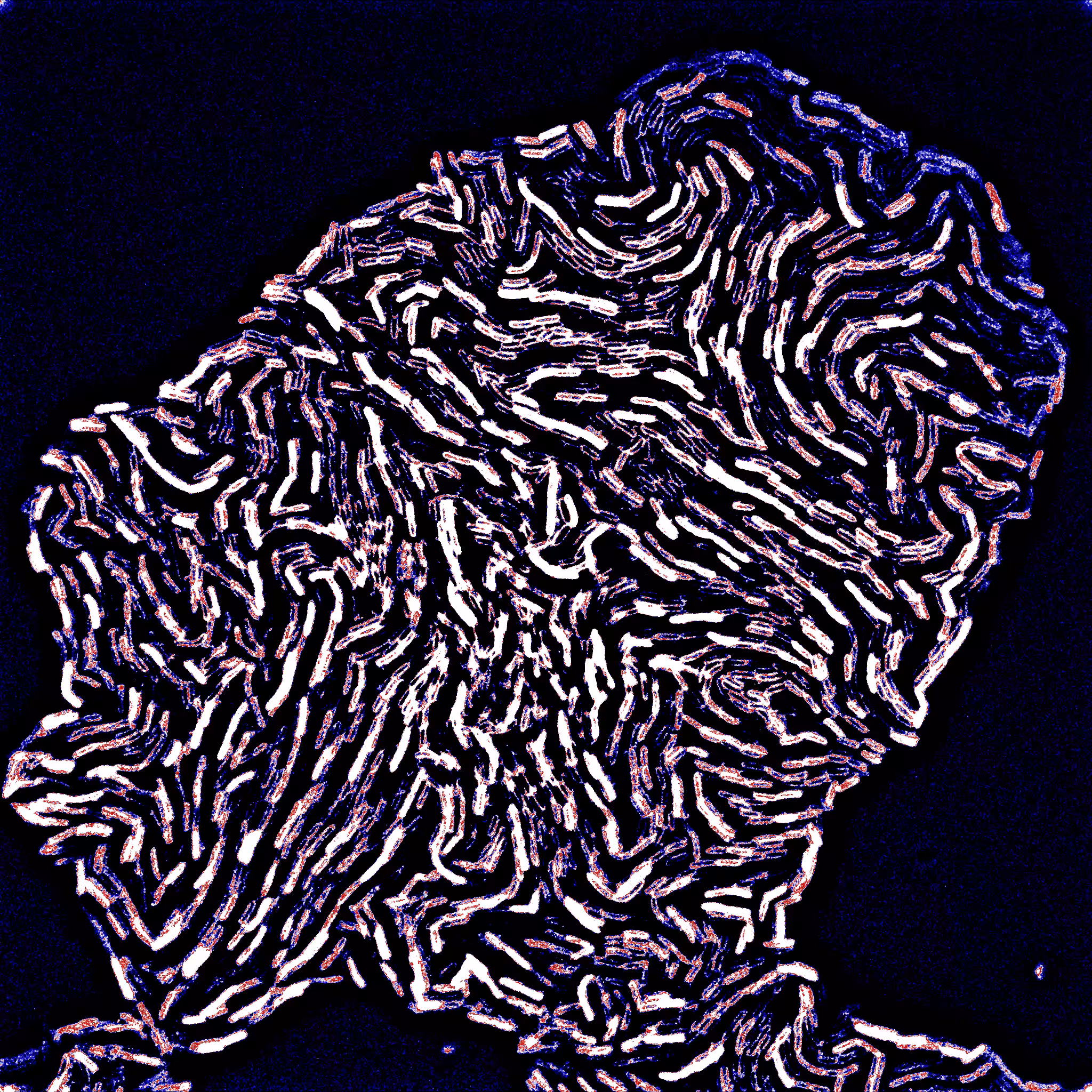 This is not a Van Gogh #4